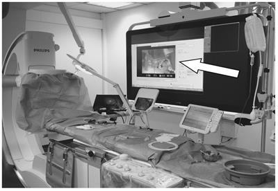 Evaluation of intracranial stenting in a simulated training and assessment environment for neuroendovascular procedures